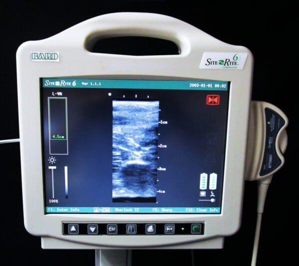 An ultrasound machine is shown on a black background.