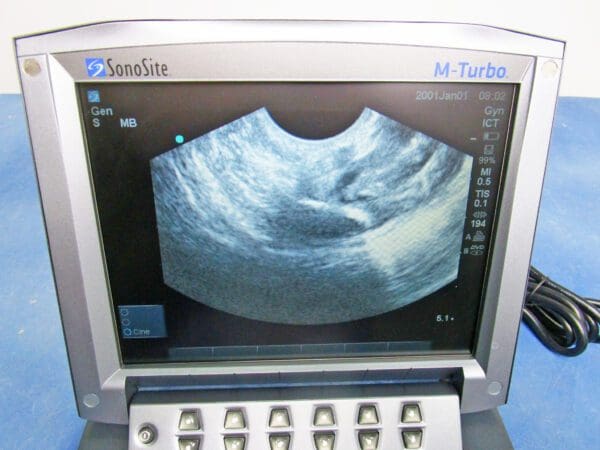A close up of an ultrasound screen