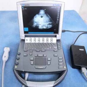 A laptop computer with an ultrasound on the screen.