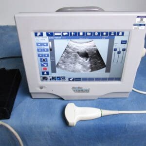 A monitor with an ultrasound image on it.