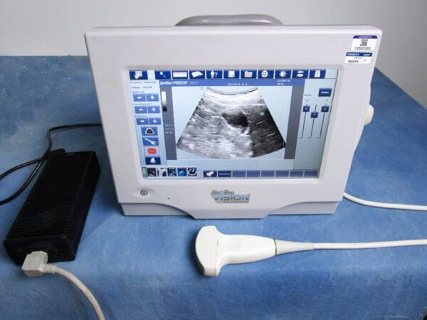 A monitor with an ultrasound image on it.